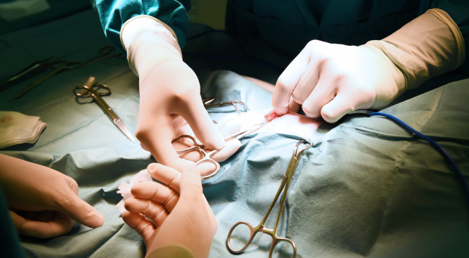 Understanding Surgical Negligence In The UK What You Need To Know